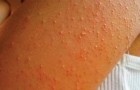 Video de Salud